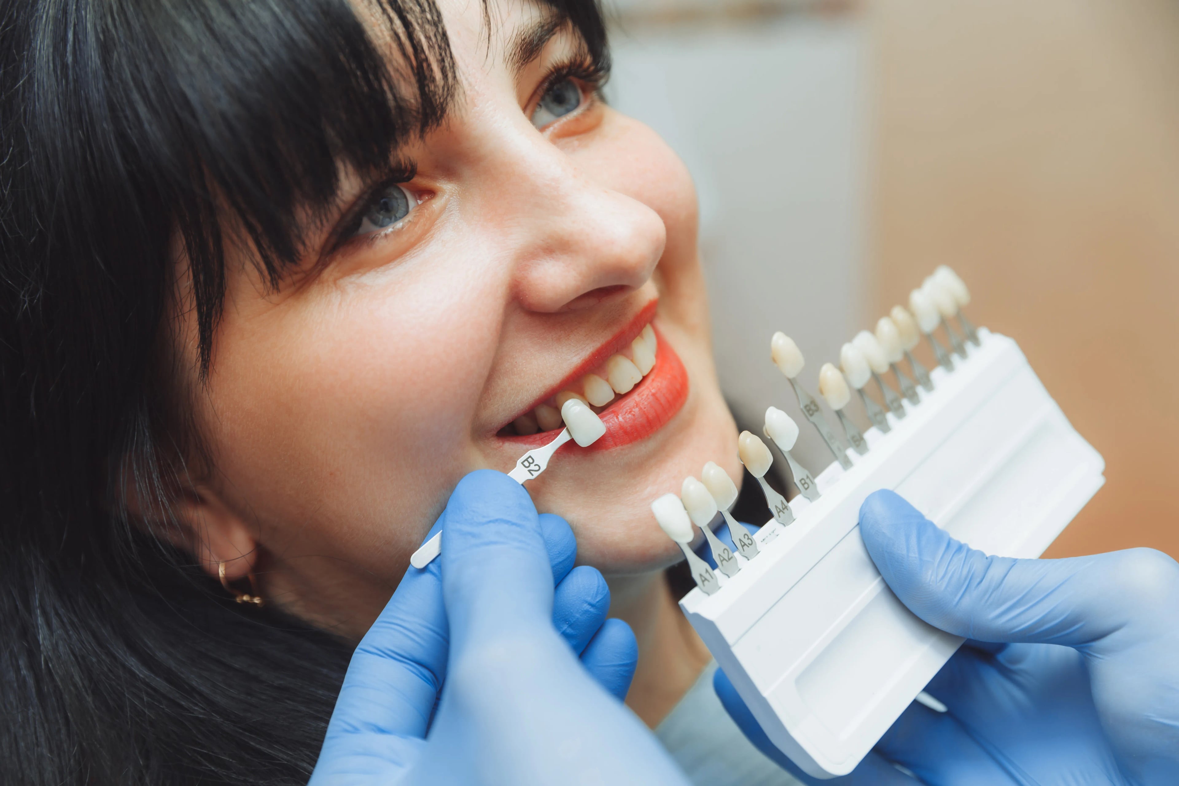 Ottawa Dental Centre Lumineers